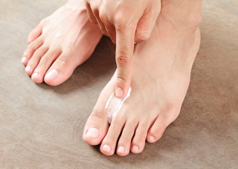 Как вылечить грибок ног народными способами thumbnail