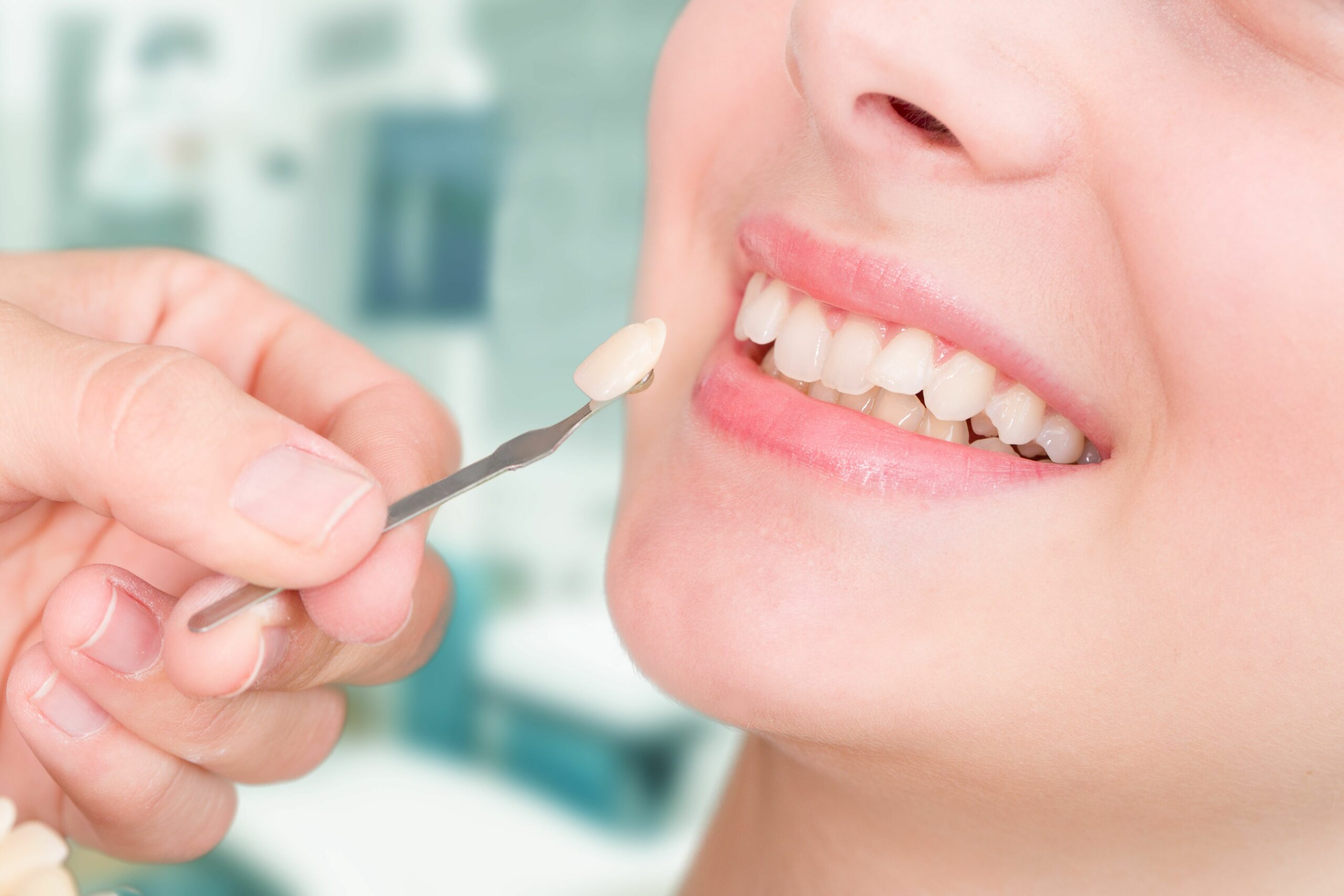 Что такое эстетическая стоматология?